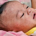Filipinos Queue Overnight For Chance Of Getting First Vaccine Dose