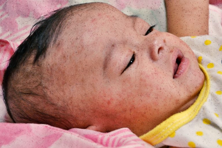 Filipinos Queue Overnight For Chance Of Getting First Vaccine Dose